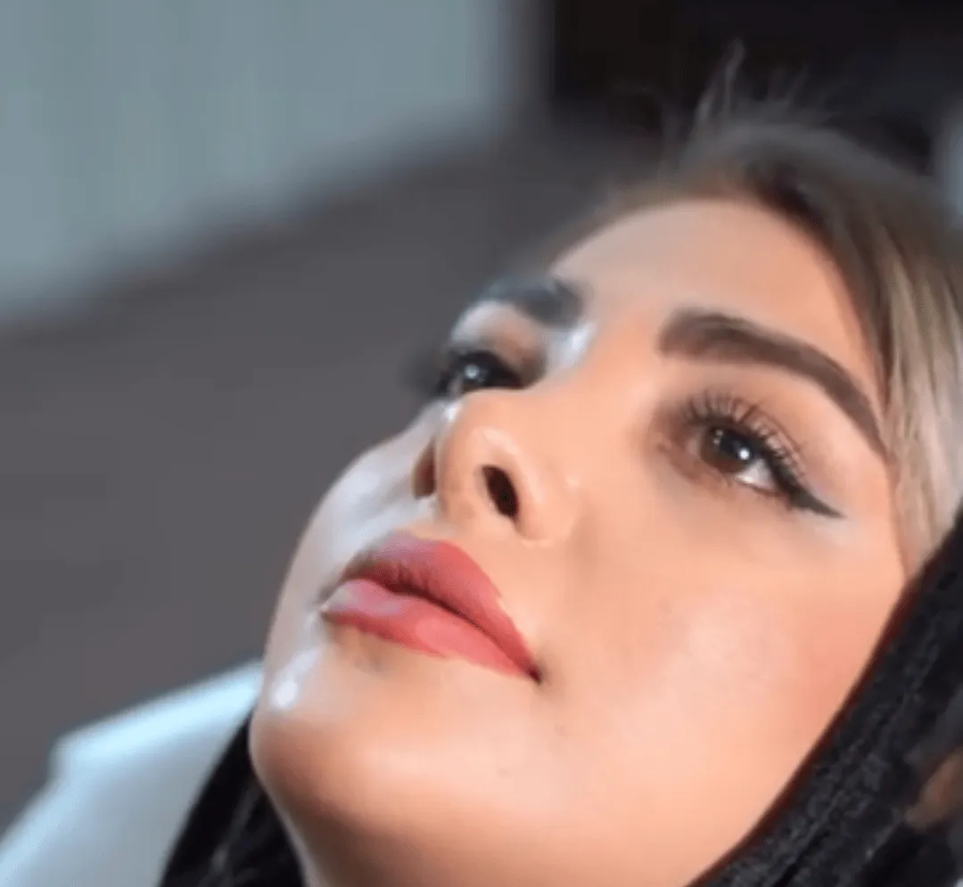 فیلر لب زیباجوی عزیز
